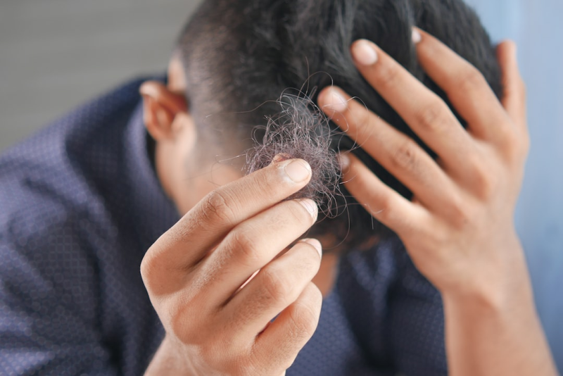 Learn about the significance of the crown in passport photos. Discover how factors like baldness and hairstyling can impact your passport photo.