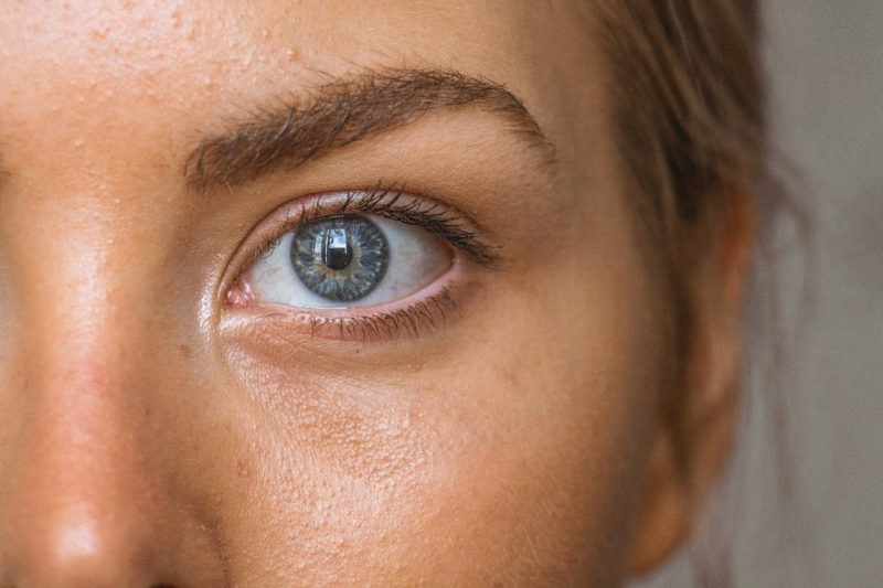 Eye bags are acceptable in passport photos as they're part of natural appearance. No rules against it.